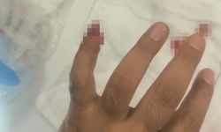 Uyuşturucuyla yakalanan şüpheli, polisin parmağını kopardı