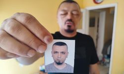Saçlarını siyahlatmak için aldığı şampuan arı sokmasından beter hale getirdi