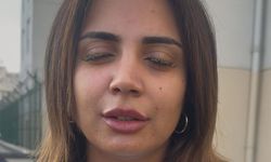 Güzellik merkezinde genç kadının gözüne yapıştırıcı kaçtı: "Kör olabilirdim"