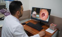 Dünyada 3'üncü kez rastlandı: Saçlı derideki nadir tümör Sakarya'da tedavi edildi