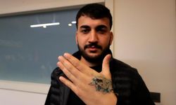 Dövme sildirmek isterken kabusu yaşadı, elindeki dokular öldü