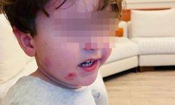 Kreşe bıraktığı çocuğunu darp edilmiş halde aldı