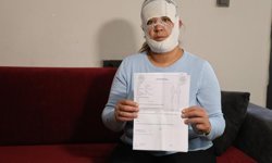 Güzelleşmek uğruna gittiği merkezde yüzü yandı