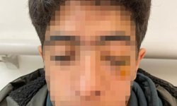 Akran zorbalığına bir yenisi eklendi: 15 yaşındaki çocuk muştayla öldüresiye dövüldü