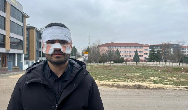 Rehber öğretmenin yüzüne sıcak çay fırlattığı fizik öğretmeni feci şekilde yandı