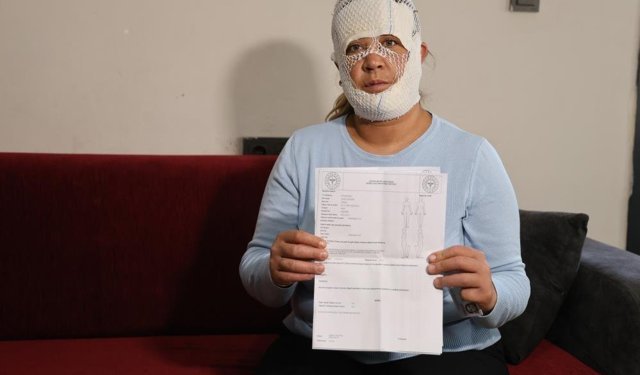 Güzelleşmek uğruna gittiği merkezde yüzü yandı